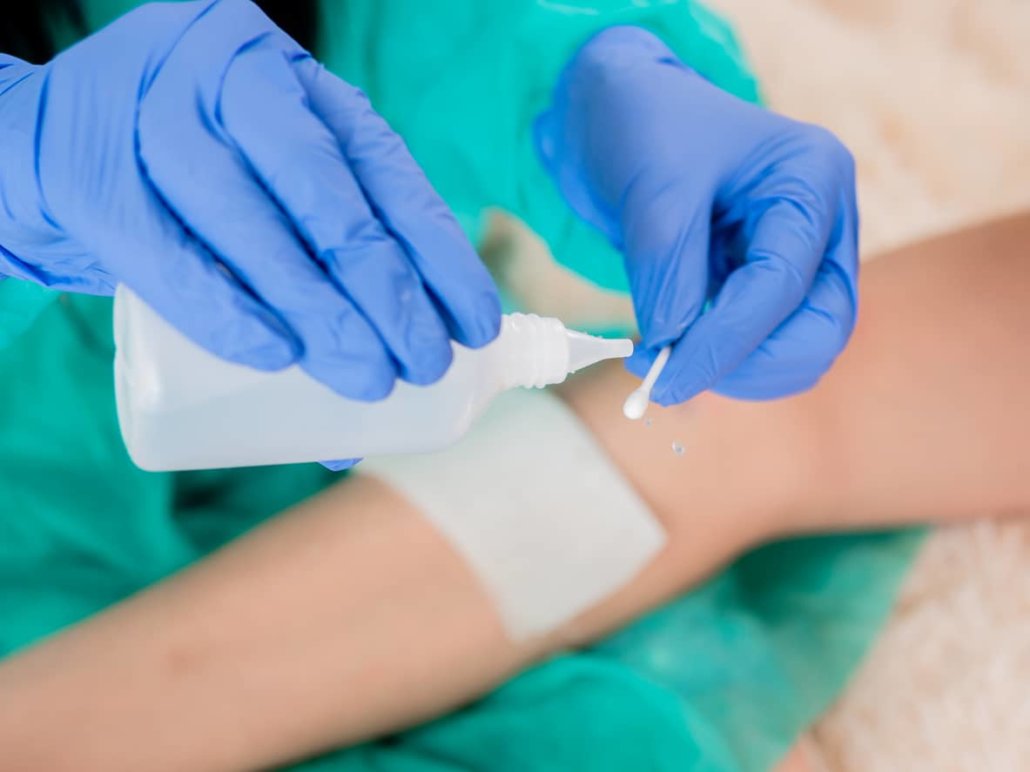 Wundversorgung beim Nebenwirkungsmanagement in der Strahlentherapie München