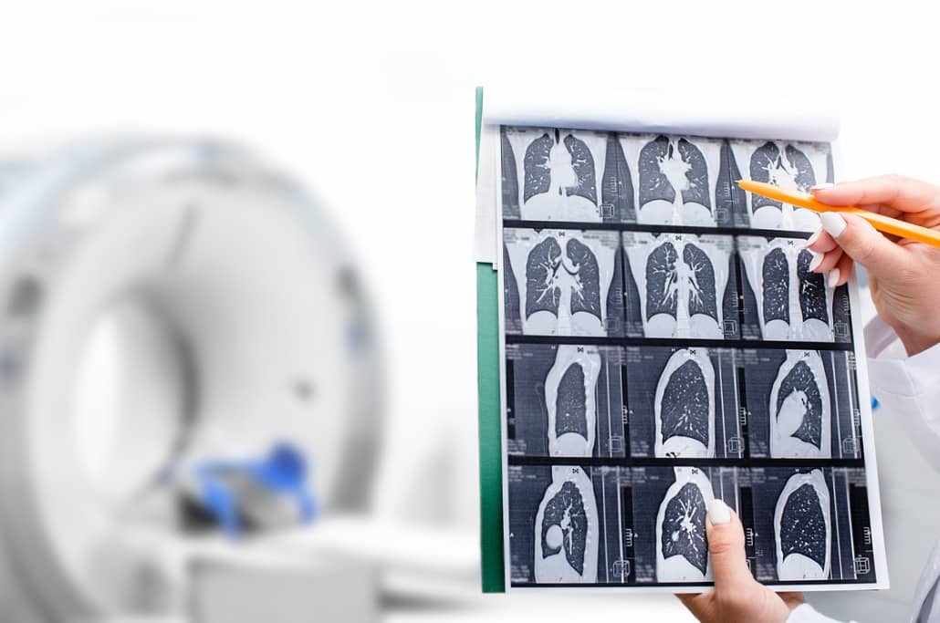 Lungenvorsorgeuntersuchung bei der Radiologie München
